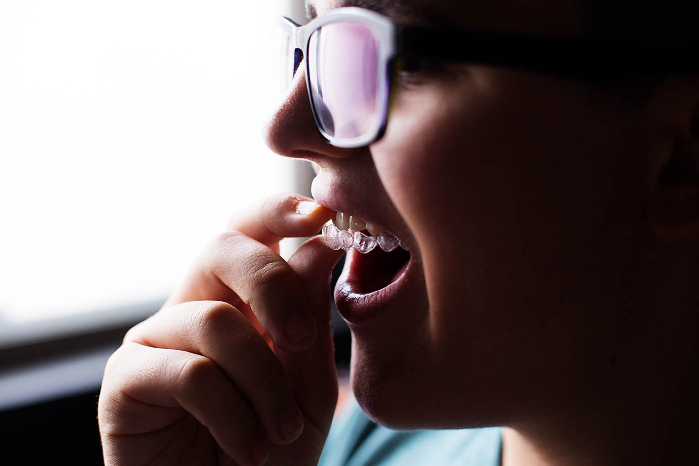 How fast does Invisalign® work? A personal experience from the lifestyle blogger at allfortheboys.com